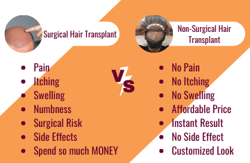 non-surgical-hair-and-hair-transplant-advantage